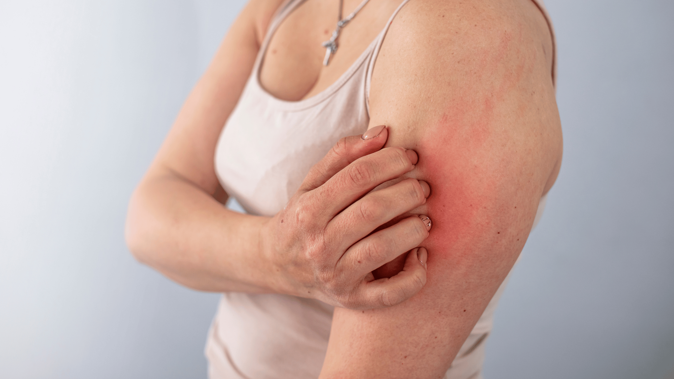 Alles wat u moet weten over verzorging van de  droge huid, volgens de dermatoloog.