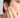 Huidadvies Acne